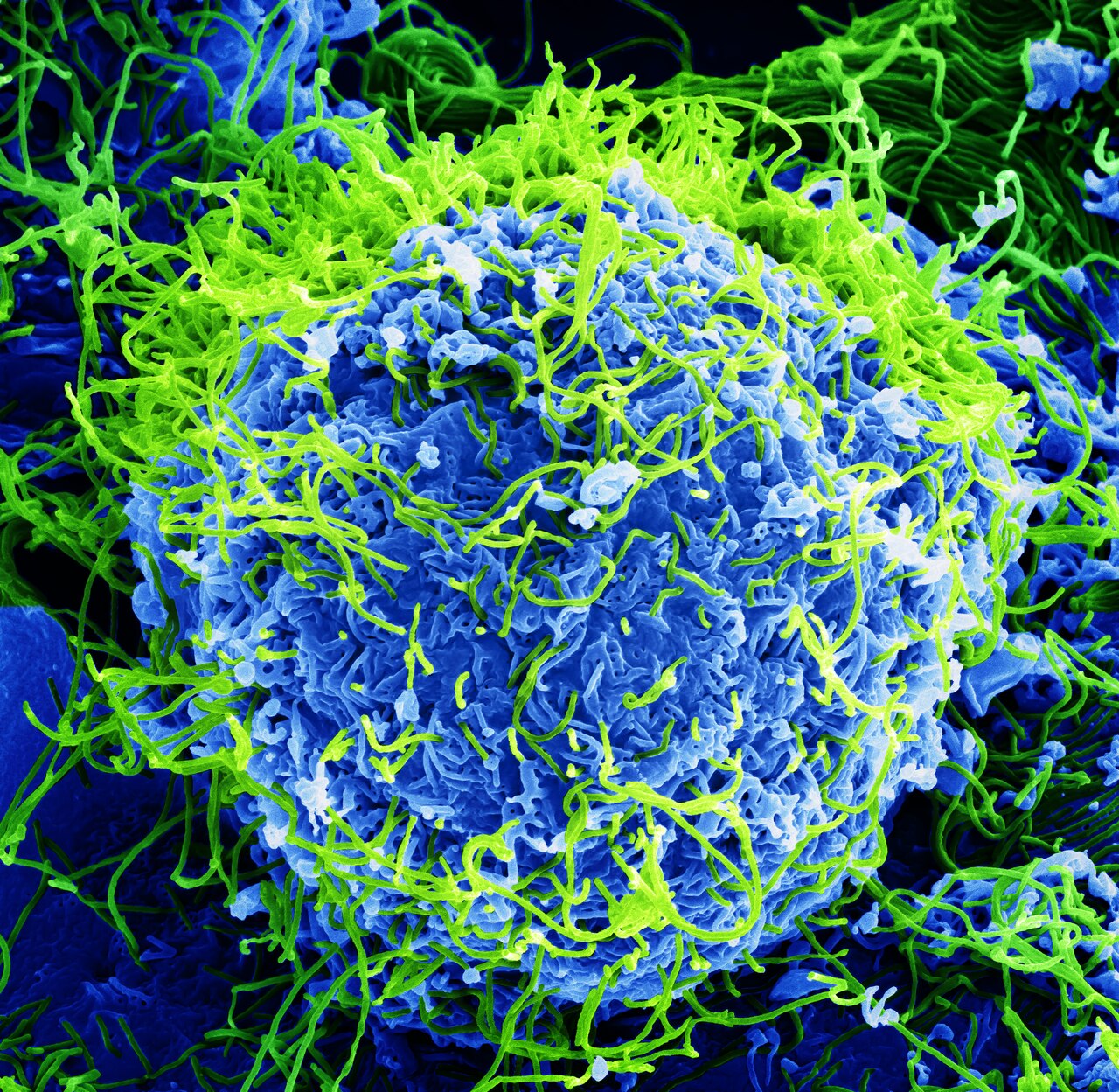 A colorized electron micrograph showing a filament-shaped Ebola virus particle.